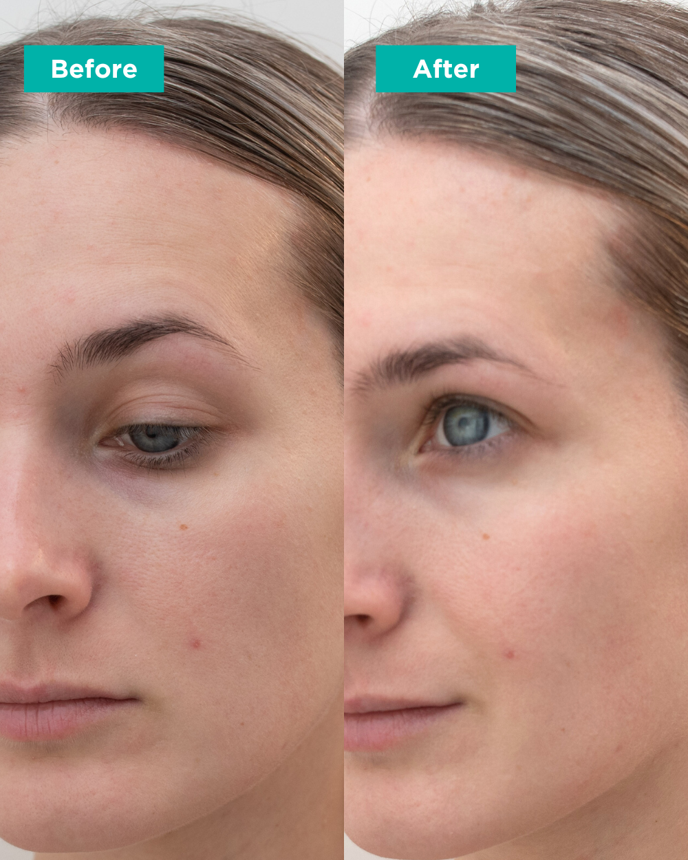 Glacial Mineral Toner