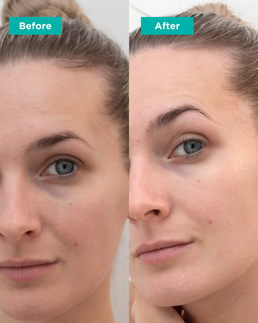 Hydrating Glacial Moisturizing Cream