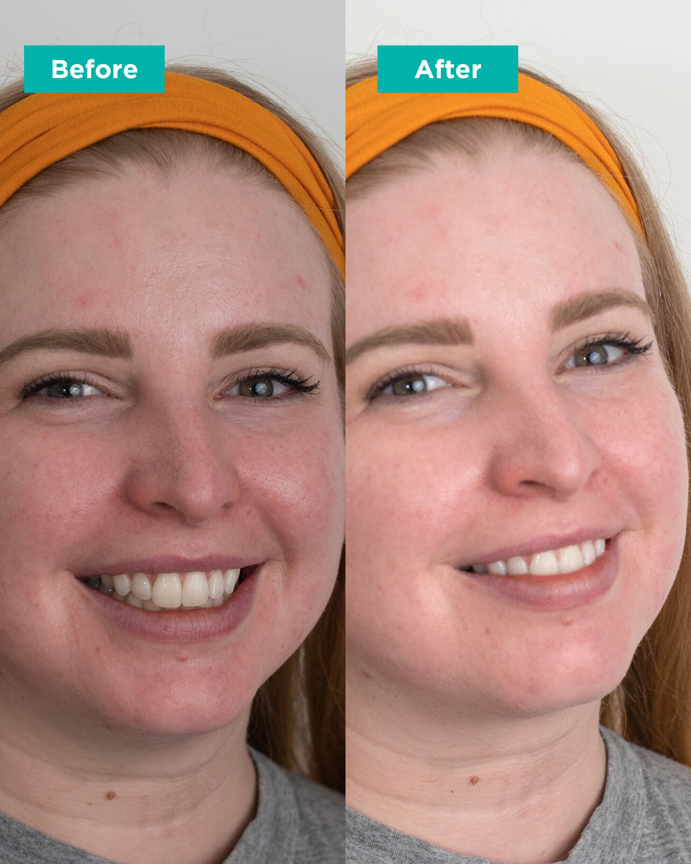 Hydrating Glacial Moisturizing Emulsion